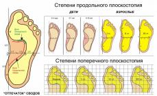 علل سوزش در پاها و روش های درمان