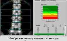Densytometria: Gatunki, metody trzymania, wyniki